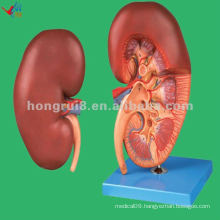 Human anatomy Kidney with Adrenal Magnified Model,Human Right Kidney Model